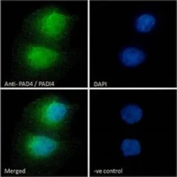 Anti-PAD4 antibody, N-term used in Immunocytochemistry/ Immunofluorescence (ICC/IF). GTX89631