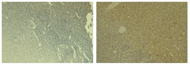 Anti-PAD4 antibody, N-term used in IHC (Paraffin sections) (IHC-P). GTX89631
