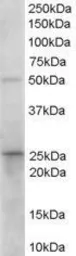 Anti-15-PGDH antibody, C-term used in Western Blot (WB). GTX89634