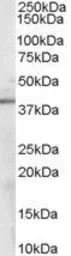 Anti-Sorbitol Dehydrogenase antibody, C-term used in Western Blot (WB). GTX89635