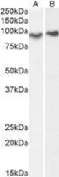 Anti-ACAP2 antibody, C-term used in Western Blot (WB). GTX89639