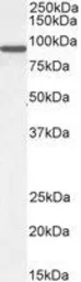 Anti-ACAP2 antibody, C-term used in Western Blot (WB). GTX89639