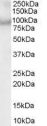 Anti-ACAP2 antibody, C-term used in Western Blot (WB). GTX89639