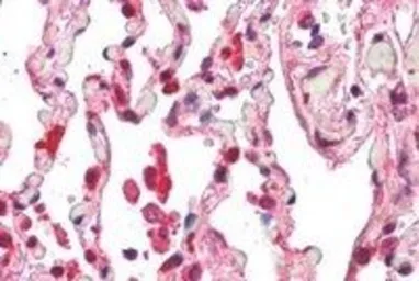 Anti-ACAP2 antibody, C-term used in IHC (Paraffin sections) (IHC-P). GTX89639