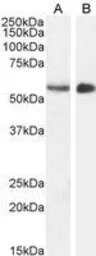 Anti-Clik1 / STK35 antibody, C-term used in Western Blot (WB). GTX89642