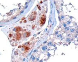 Anti-Clik1 / STK35 antibody, C-term used in IHC (Paraffin sections) (IHC-P). GTX89642
