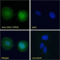 Anti-Clik1 / STK35 antibody, C-term used in Immunocytochemistry/ Immunofluorescence (ICC/IF). GTX89642