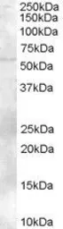 Anti-TZFP antibody, C-term used in Western Blot (WB). GTX89643
