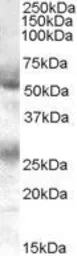 Anti-FLVCR antibody, C-term used in Western Blot (WB). GTX89644