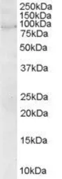 Anti-ARHGEF4 antibody, N-term used in Western Blot (WB). GTX89645