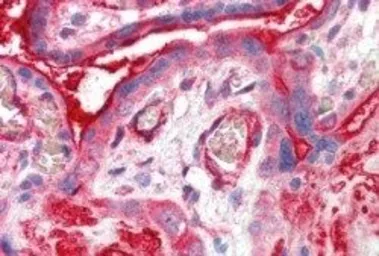 Anti-Centaurin alpha 2 antibody, C-term used in IHC (Paraffin sections) (IHC-P). GTX89646