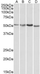 Anti-AKT3 antibody, Internal used in Western Blot (WB). GTX89647