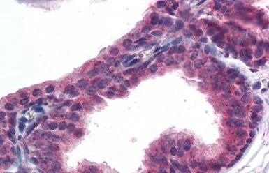 Anti-AKT3 antibody, Internal used in IHC (Paraffin sections) (IHC-P). GTX89647