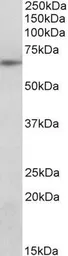 Anti-SOCS5 antibody, N-term used in Western Blot (WB). GTX89655