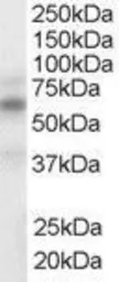 Anti-LXR alpha / LXR beta antibody, Internal used in Western Blot (WB). GTX89656