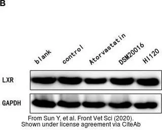 Anti-LXR alpha / LXR beta antibody, Internal used in Western Blot (WB). GTX89656