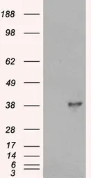 Anti-DOK5 antibody, C-term used in Western Blot (WB). GTX89660