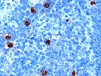 Anti-DOK5 antibody, C-term used in IHC (Paraffin sections) (IHC-P). GTX89660