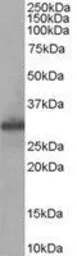 Anti-FHL1 antibody, Internal used in Western Blot (WB). GTX89663