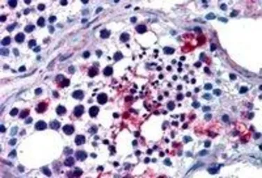 Anti-FHL1 antibody, Internal used in IHC (Paraffin sections) (IHC-P). GTX89663