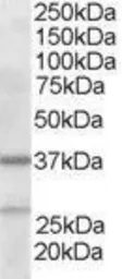 Anti-p41-ARCb antibody, N-term used in Western Blot (WB). GTX89664