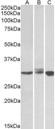 Anti-Livin antibody, C-term used in Western Blot (WB). GTX89665