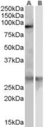 Anti-SCARF1 antibody, Internal used in Western Blot (WB). GTX89666