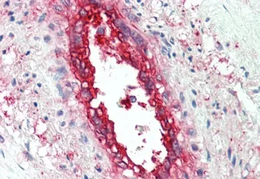 Anti-EHD2 antibody, C-term used in IHC (Paraffin sections) (IHC-P). GTX89668