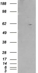Anti-Retinoid X Receptor beta antibody, Internal used in Western Blot (WB). GTX89670