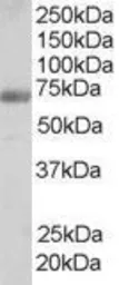 Anti-FNBP1 antibody, Internal used in Western Blot (WB). GTX89672