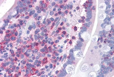 Anti-FNBP1 antibody, Internal used in IHC (Paraffin sections) (IHC-P). GTX89672