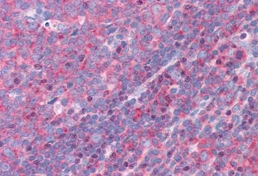 Anti-FNBP1 antibody, Internal used in IHC (Paraffin sections) (IHC-P). GTX89672