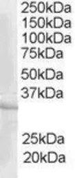 Anti-CREM antibody, C-term used in Western Blot (WB). GTX89673