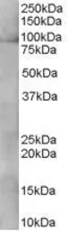 Anti-XAB2 antibody, C-term used in Western Blot (WB). GTX89674