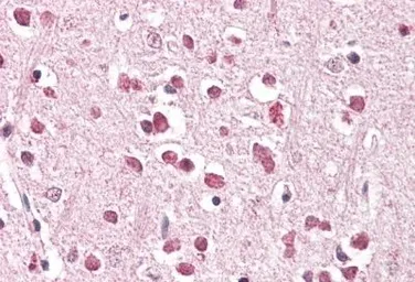 Anti-XAB2 antibody, C-term used in IHC (Paraffin sections) (IHC-P). GTX89674