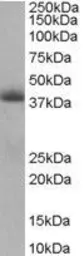 Anti-TIMM50 antibody, Internal used in Western Blot (WB). GTX89675