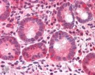 Anti-BAZ2B antibody, C-term used in IHC (Paraffin sections) (IHC-P). GTX89680