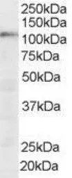 Anti-SART1 antibody, N-term used in Western Blot (WB). GTX89682