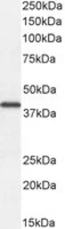 Anti-DKK1 antibody, C-term used in Western Blot (WB). GTX89683