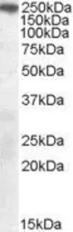 Anti-SorLA antibody, C-term used in Western Blot (WB). GTX89685