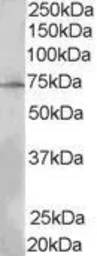 Anti-LNK antibody, N-term used in Western Blot (WB). GTX89686