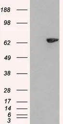 Anti-LNK antibody, N-term used in Western Blot (WB). GTX89686