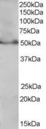 Anti-PPAR delta (Isoform 1) antibody, C-term used in Western Blot (WB). GTX89687