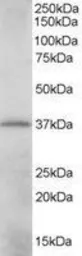 Anti-CrkL antibody, C-term used in Western Blot (WB). GTX89690