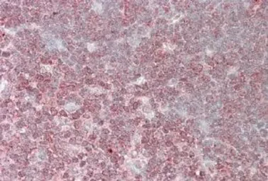 Anti-CrkL antibody, C-term used in IHC (Paraffin sections) (IHC-P). GTX89690