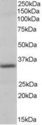 Anti-Pirin antibody, N-term used in Western Blot (WB). GTX89691