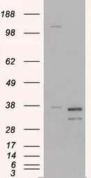 Anti-Pirin antibody, N-term used in Western Blot (WB). GTX89691