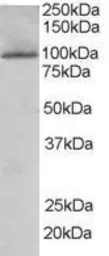 Anti-JIK antibody, Internal used in Western Blot (WB). GTX89693