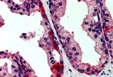 Anti-JIK antibody, Internal used in IHC (Paraffin sections) (IHC-P). GTX89693