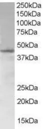 Anti-SAMSN1 antibody, N-term used in Western Blot (WB). GTX89694
